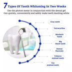 Teeth Whitening Accelerator Smart LED Blue Light Portable Usb/Iphone/Android Charging Device Teeth Whitener Light Gum Tray